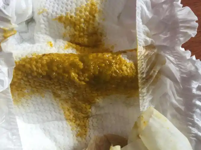 37天大宝宝拉屎有黏糊糊的透明状的东西