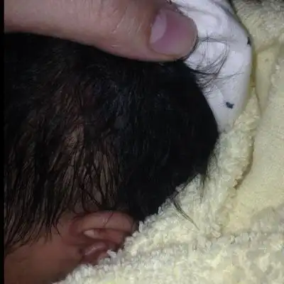 为什麼会这样,头皮前面是肉色,耳朵后面的头皮全是黑色的,怎麼办,会不