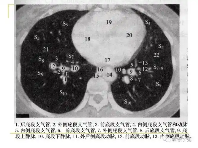 肺段切除术说人话右肺基底段切除术前传