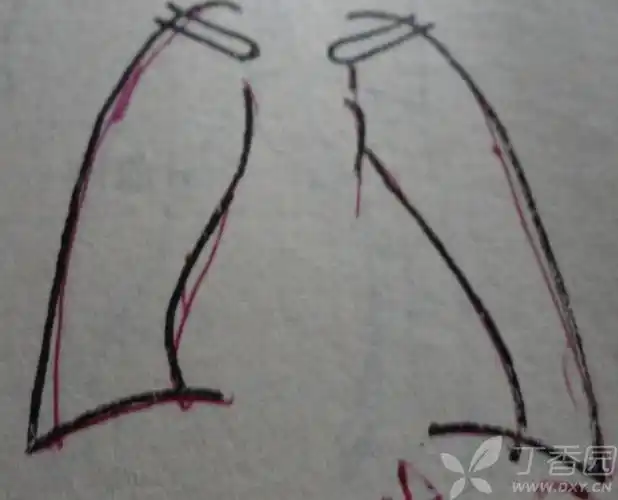 普大型心,梨形心,靴形心的片子究竟怎么看啊-丁香园