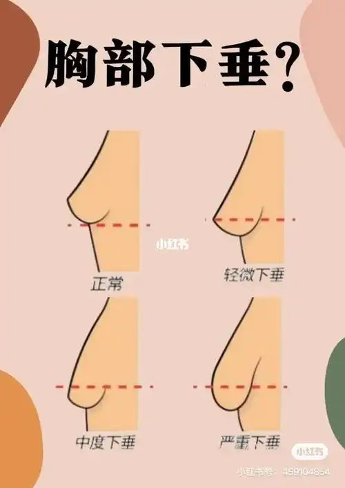 下垂的93穿什么内衣