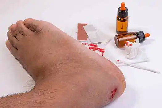 清新,出血,脚跟,急救用品,急救,设备,紧急,医疗,商品,伤,皮肤,意外