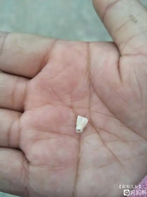 梦见掉牙齿是什么意思_梦见自己的牙齿掉了_梦见掉牙齿是什么意思还