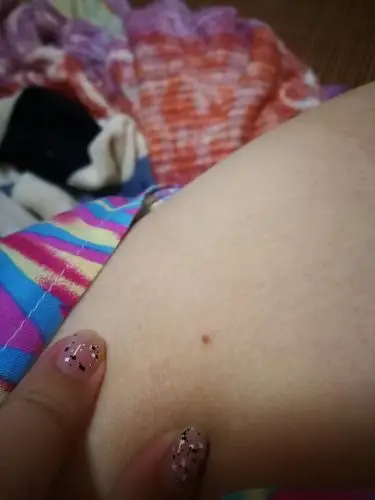 腋下突然长了肉一样的小东西,求解.