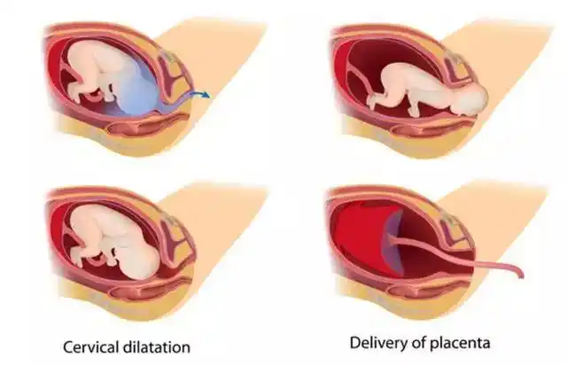 原创分娩不知道如何用力?了解七张图就够了,建议收藏
