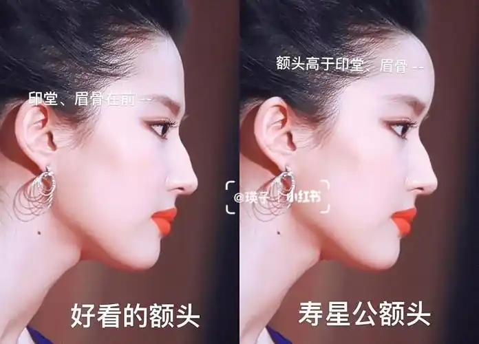 26615额头高于印堂眉骨就会有种寿星公的即视感,印堂和眉骨一定要