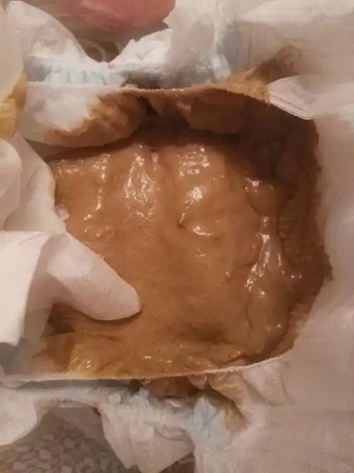 宝宝大便酸酸的,放屁也很臭,肠鸣严重,肚子叫的时候就使劲,会大哭