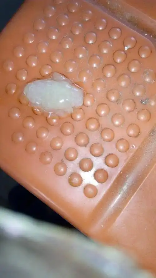 我每天早上起床都会吐这样的一口痰 这是什么原因?