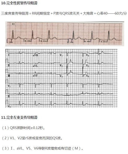 2021年临床执业医师考试实践技能心电图诊断考点一文速记
