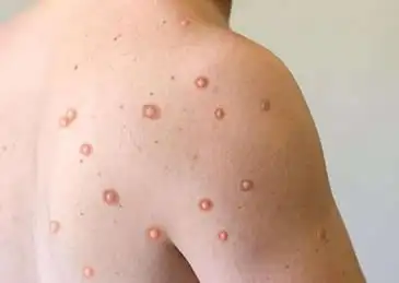 美国传染病学专家闻听这一病例时,也不禁感叹:"这实