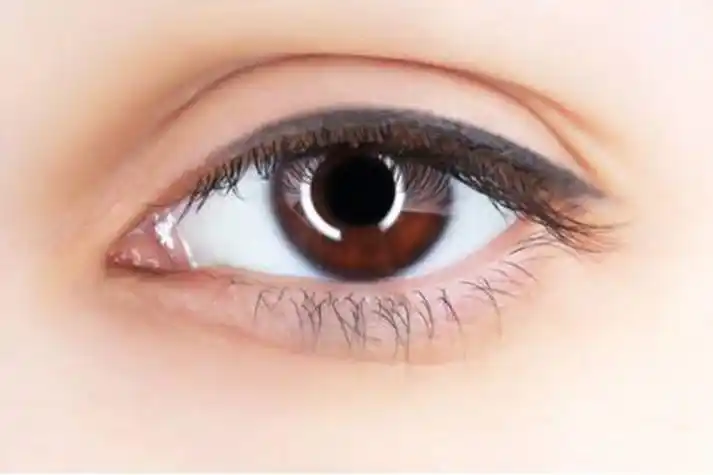 眼球突出与正常眼图片