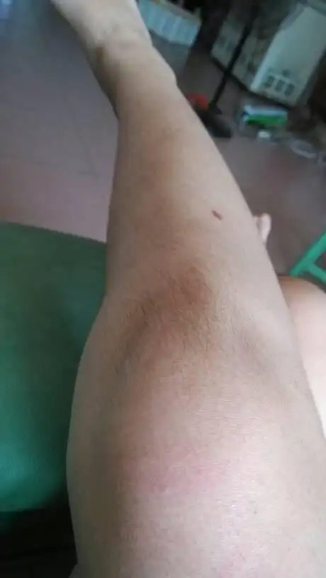 女人的腿为什么也会长这么多毛毛?