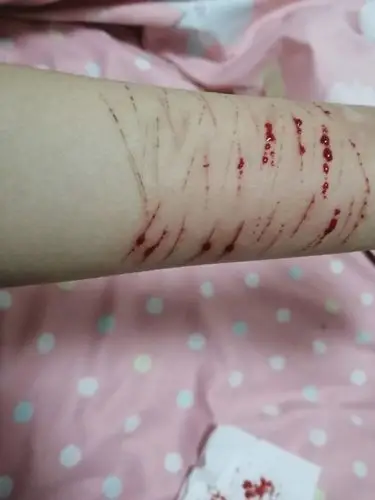 对事情提不起来兴趣,嗜睡,经常想哭和忍不住发脾气,而且还自残,感觉吃