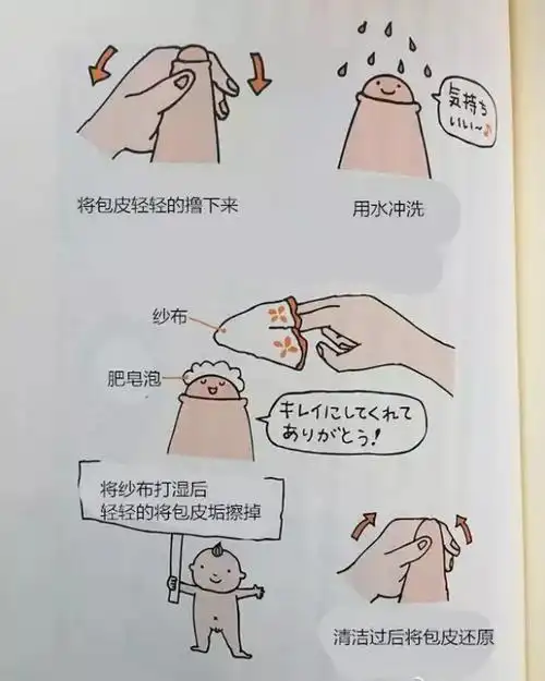 呵护男宝从小鸡鸡开始