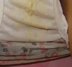 女士原味带分泌物 - 搜狗图片搜索