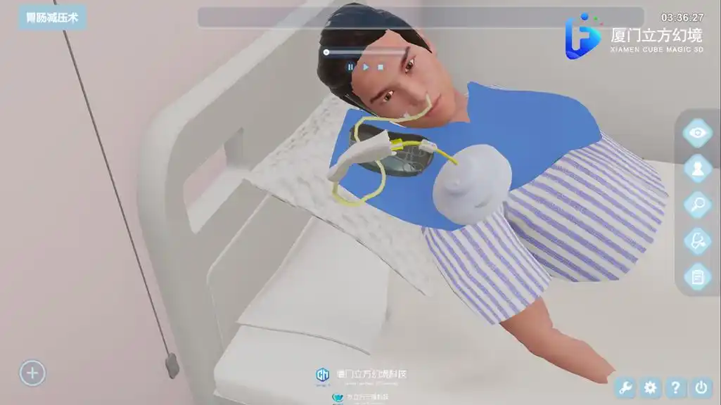 虚拟仿真技术在胃肠减压术培训中的应用