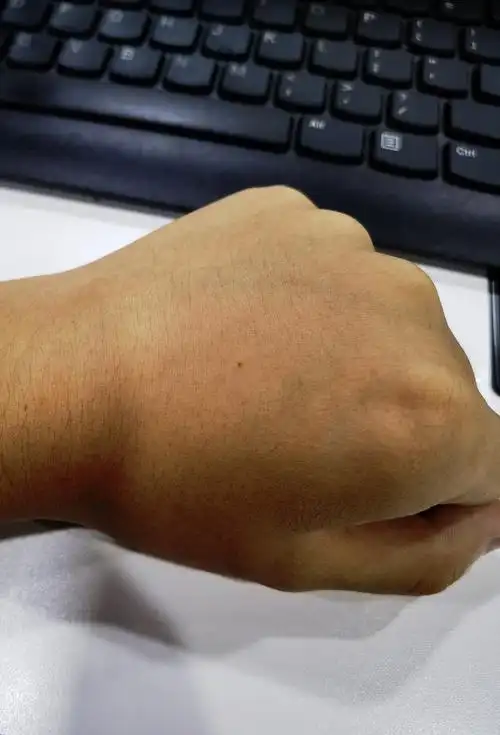 相机拍皮肤自带死鱼皮尸斑滤镜