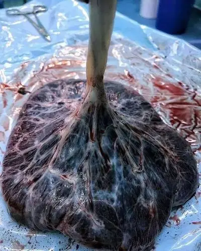 瞬间长知识脂肪肌肉差这么多