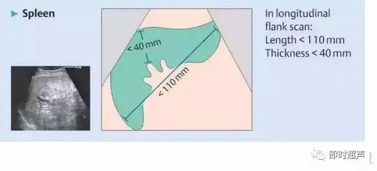 脾脏超声诊断