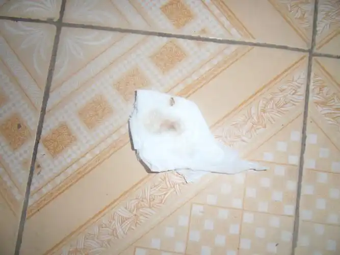 4,5个月前怀疑是肺结核,去疾控中心做过ppd和痰检.