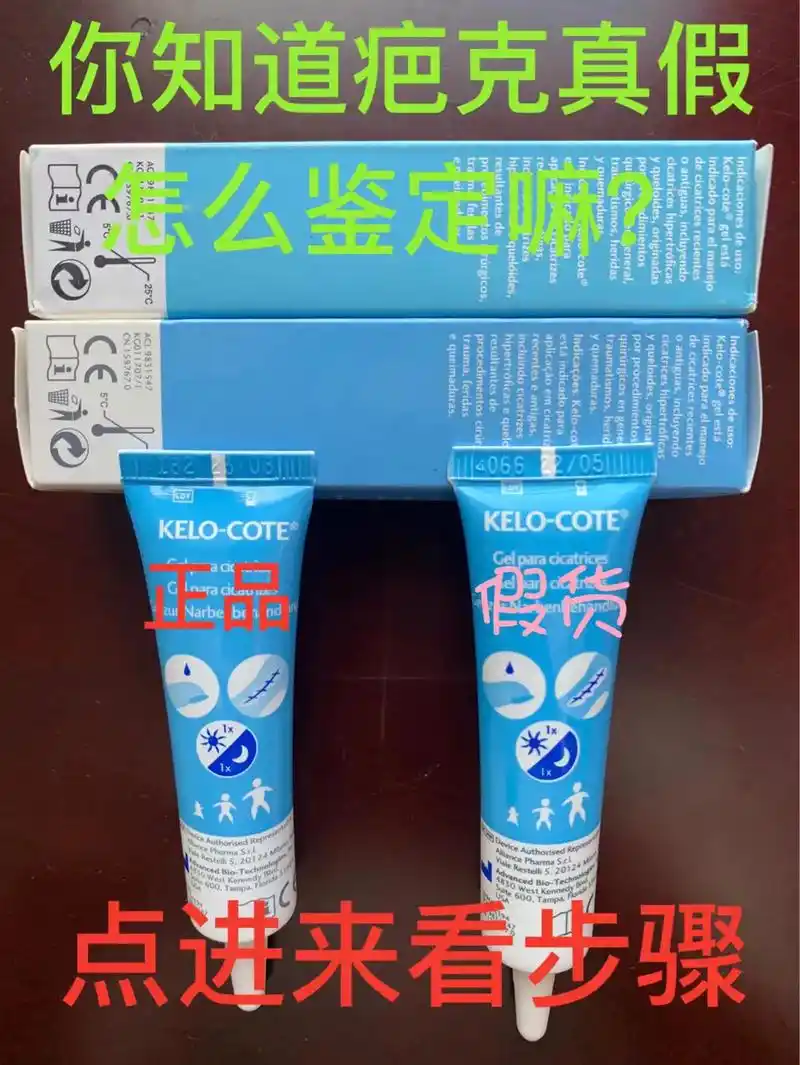 美国疤克真假鉴定  美国疤克真假对比辨别8715看准这几点6015