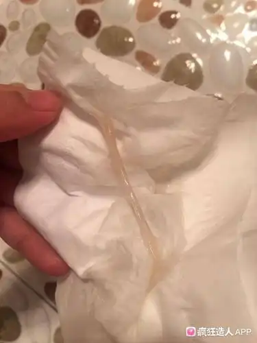 请问这是已经排除的卵泡吗