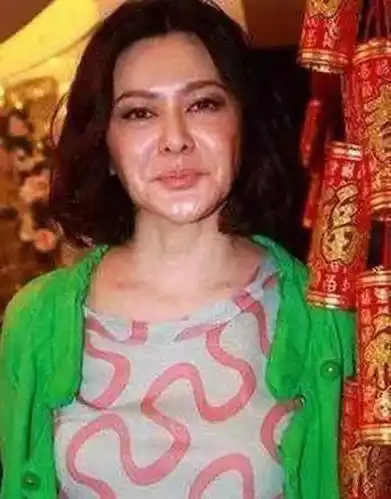 盘点那些整容失败的女星她们星途尽毁整容有风险且整且珍惜