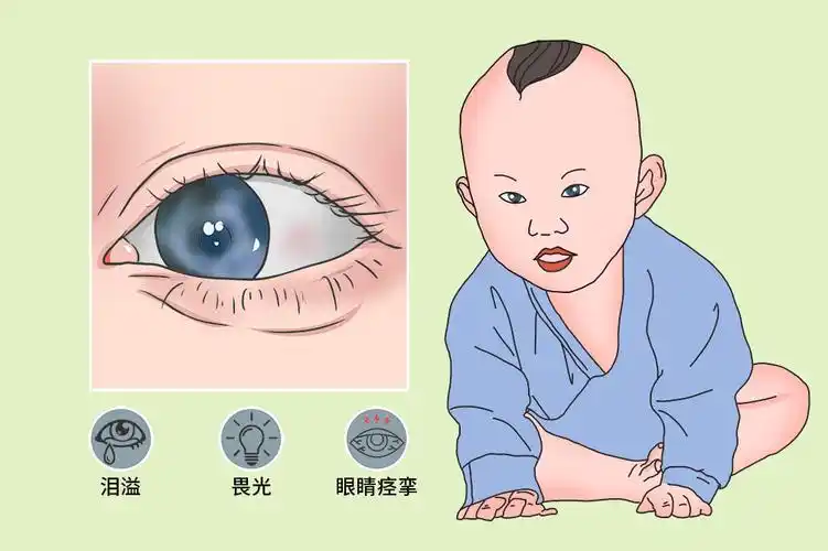 婴幼儿型青光眼