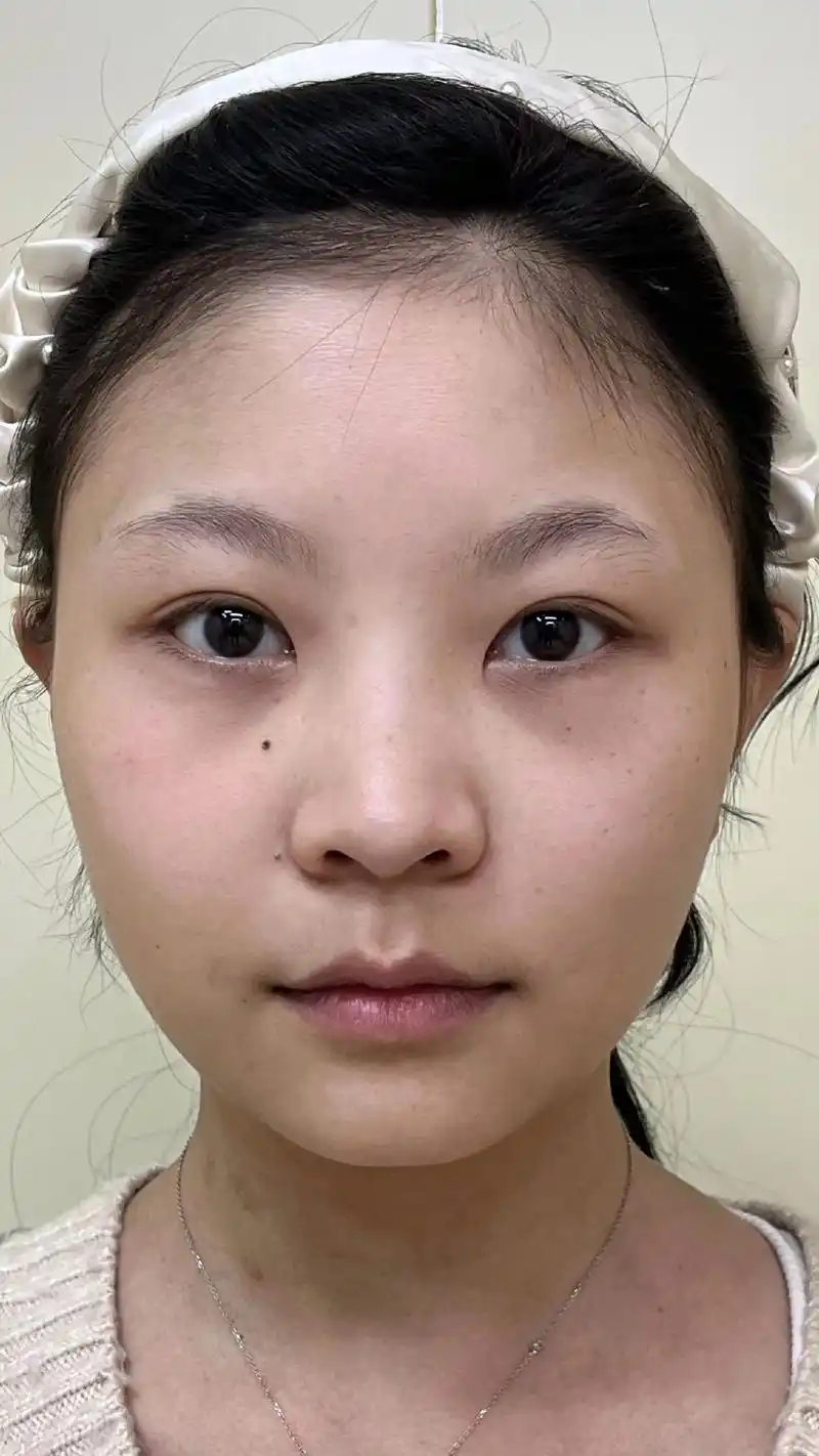 t区轮廓塑造,告别扁平脸,小姐姐变美瞬间惊艳了～#素人改造  - 抖音