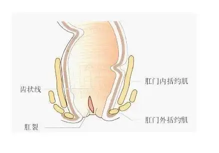 宝宝肛裂图片 (24)_有来医生