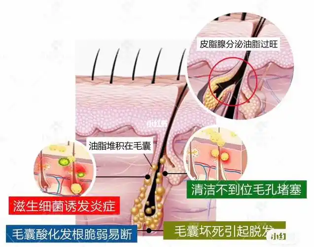 温哥华头皮管理【头皮检测·头皮问题】