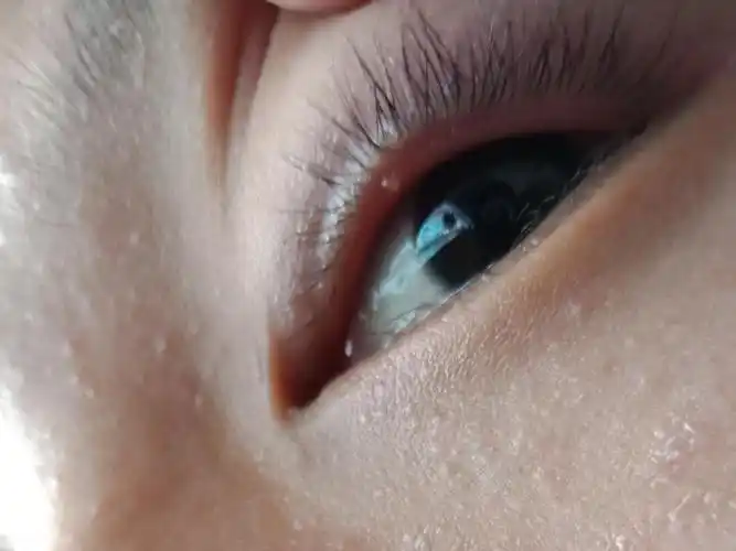 眼皮里长了这么一个东西没有什么感觉就是眨眼有点磨眼求告知这是什么