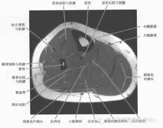 小腿部断层解剖 详细标注_全网_影像_系统