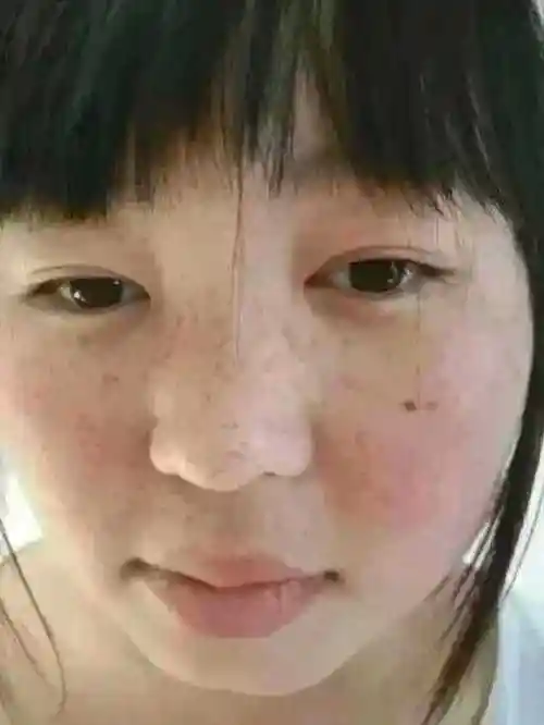 我来脸上很多的斑点,问了好多人都说不好搞,不知道曦城老师能不能帮