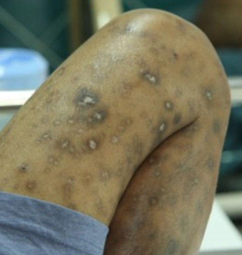 艾滋的漫画图片