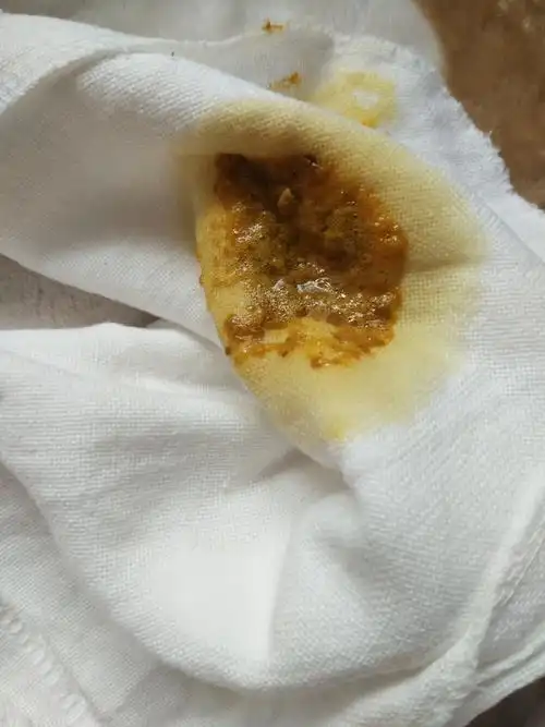 同样也需要进行喂养的配合因为腹泻的宝宝脱水是最大的危险,会造成