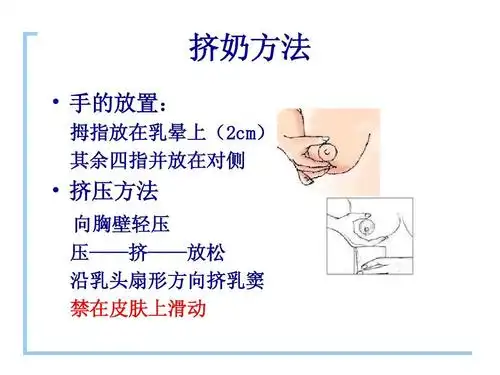 母乳喂养---挤奶的方法ppt