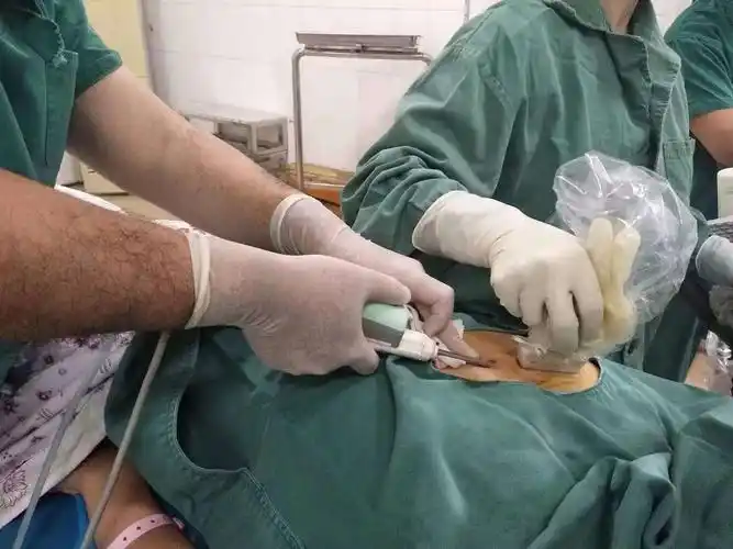 微创手术治疗乳腺纤维瘤的护理心得