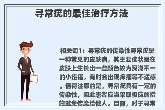 寻常疣的最佳治疗方法