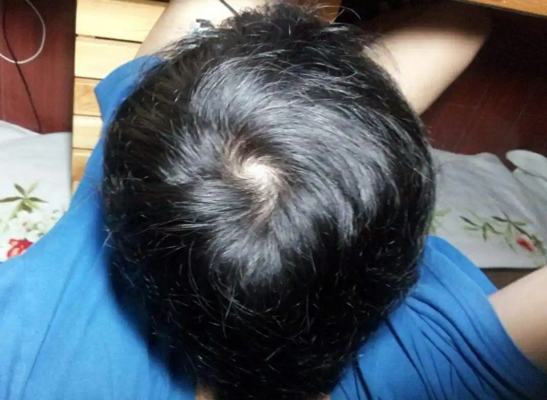 头顶上有两个旋的宝宝更聪明?其实最终决定孩子聪明的因素是