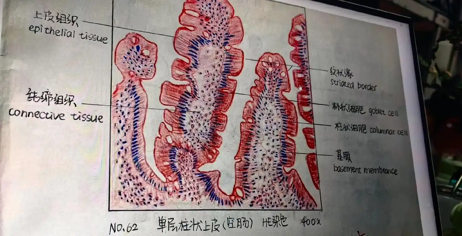 单层柱状上皮 #发疯日常 #享受生活 #学校生活 #单层柱状 - 抖音