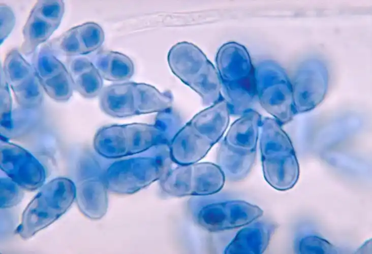 显微镜下的细菌图片第11张