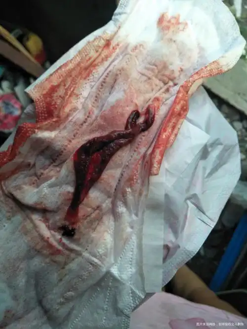 姐妹们帮看看这个是啥月经排出来的好大一个东西