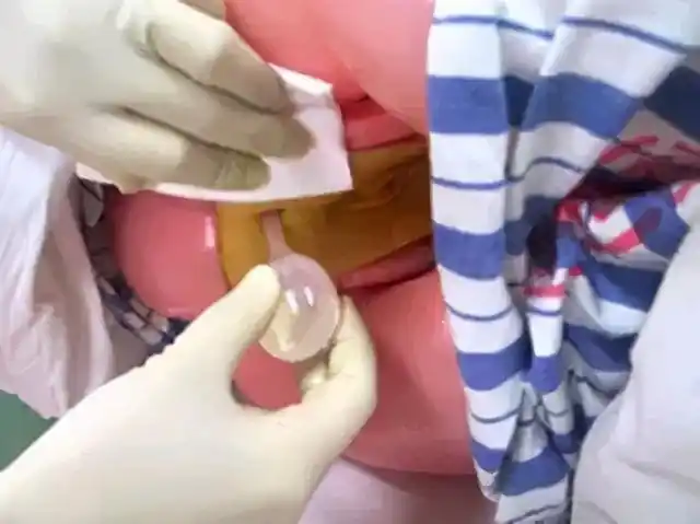 开塞露,你用对了吗?|便秘|甘油|直肠|症状_网易订阅