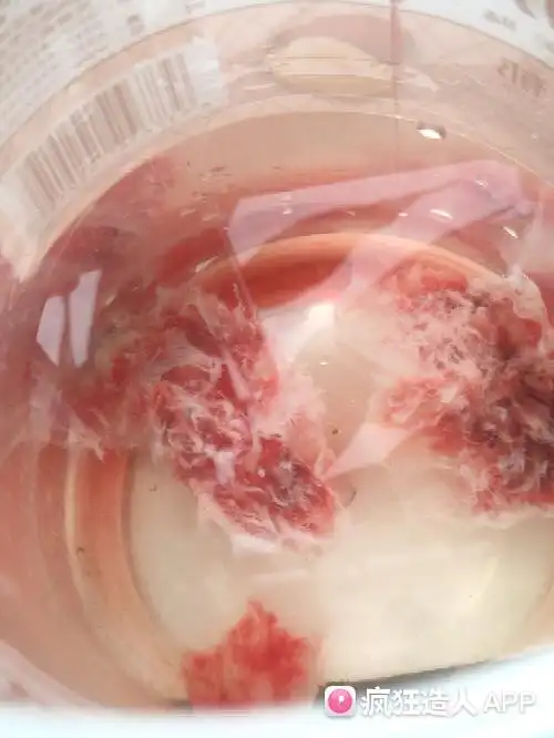 囊胚移植第20天,生化流产了