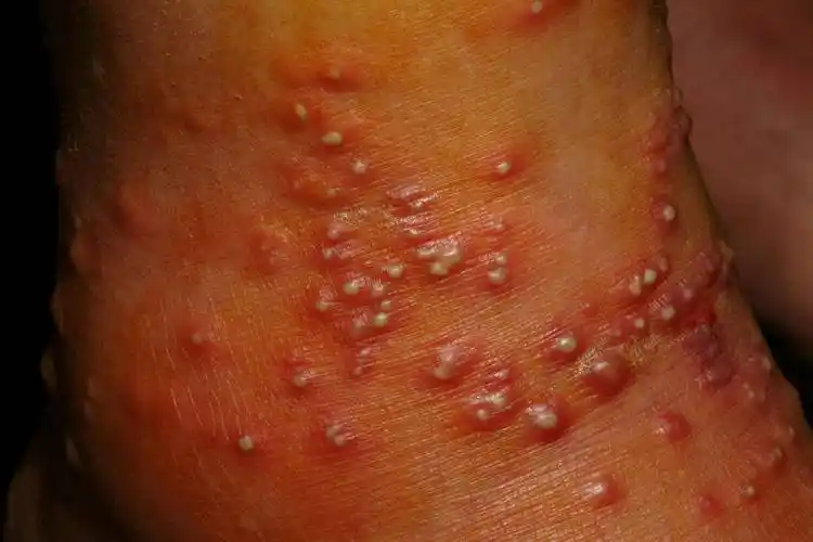 原创入侵我国12省份红火蚁有多厉害号称地表最强入侵物种