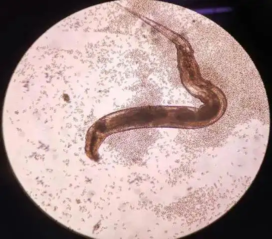 小儿肛门会阴部瘙痒谨防蛲虫病