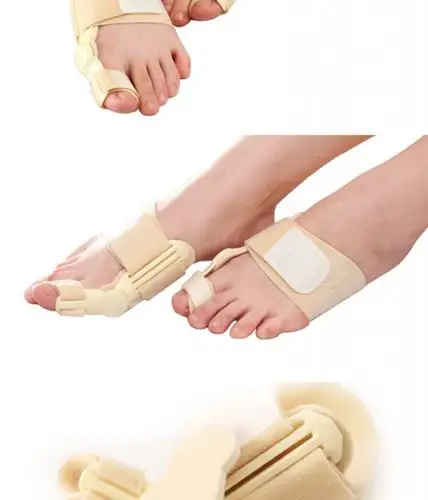 国家专利 敏斯特品牌 拇外翻矫正器 大脚骨矫形器 拇指外翻矫正