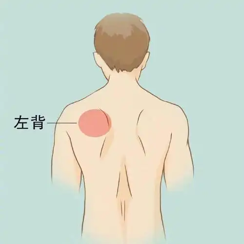 后背疼可能是哪里出问题了分享78