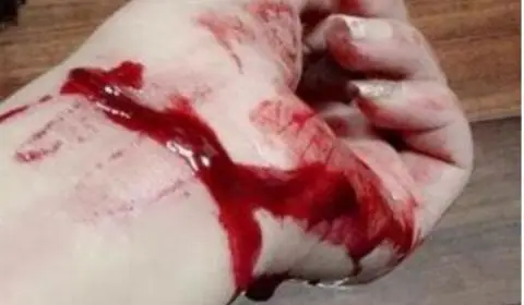 女子醉酒后留遗言微信直播割腕 幸好警方赶到及时